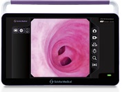 SCIVITA přenosný endoskopický video procesor